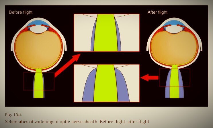 Trở về Tr&aacute;i đất sau chuyến du h&agrave;nh vũ trụ, đ&ocirc;i mắt của nhiều phi h&agrave;nh gia đ&atilde; thay đổi- Ảnh 2.