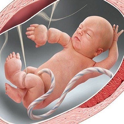 Thai Nhi 21 Tuần Bị Cắt Cụt Các Ngón Tay Vì Một Thứ Thai Nhi 21 Tuần Bị Cắt Cụt Các Ngón Tay Vì Một Thứ
