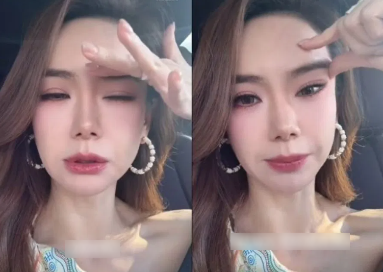 Nữ Diễn Viên Nổi Tiếng Thừa Nhận Gương Mặt Nữ Diễn Viên Nổi Tiếng Thừa Nhận Gương Mặt