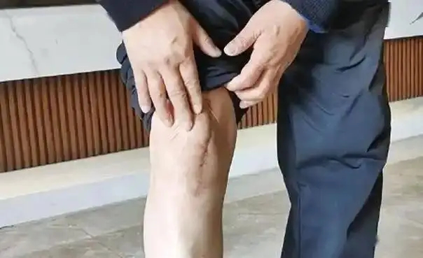 Đàn ông có già đi hay không, nhìn "phần dưới cơ thể" là biết: Nếu không có các dấu hiệu này thì xin chúc mừng - Ảnh 3. Đàn ông có già đi hay không, nhìn "phần dưới cơ thể" là biết: Nếu không có các dấu hiệu này thì xin chúc mừng - Ảnh 3.