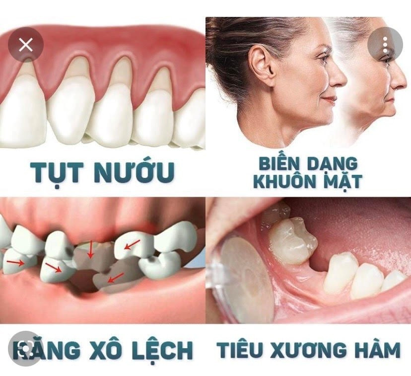 - Ảnh 2. - Ảnh 2.