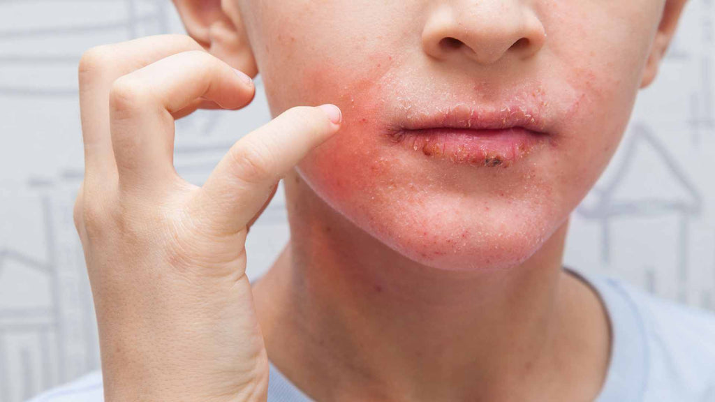 Người có gan yếu thường có 4 điểm chung trên khuôn mặt: Có 1 cũng nên đi khám ngay!- Ảnh 3. Người có gan yếu thường có 4 điểm chung trên khuôn mặt: Có 1 cũng nên đi khám ngay!- Ảnh 3.