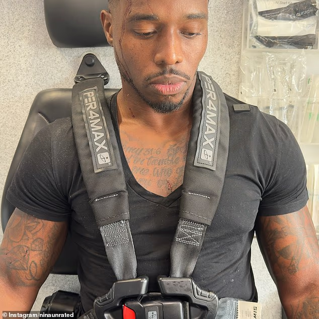 Cặp đôi igặp tai nạn kinh hoàng khi quay mukbang trong nhà hàng - Ảnh 2.