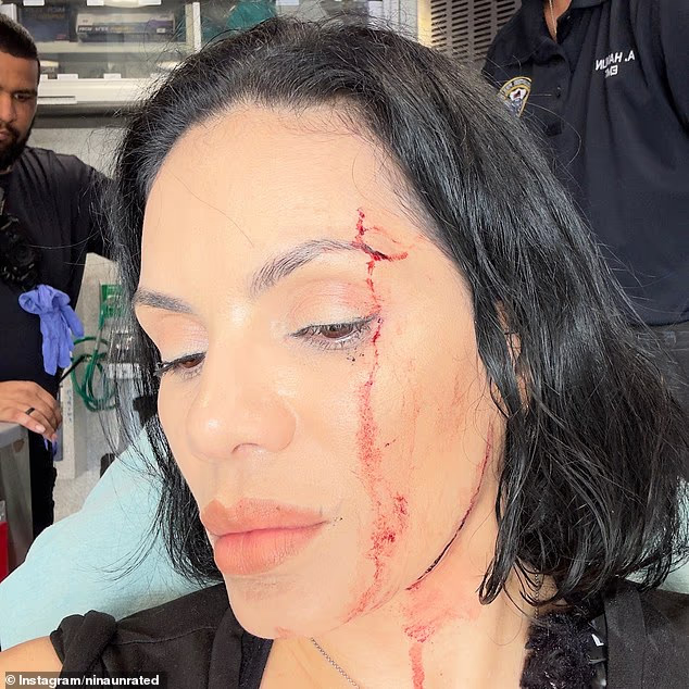 Cặp đôi igặp tai nạn kinh hoàng khi quay mukbang trong nhà hàng - Ảnh 1.