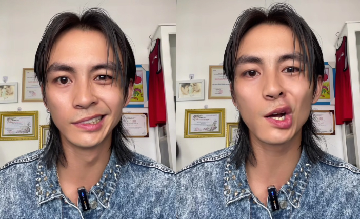 Nam thần Vbiz tiết lộ bị liệt dây thần kinh số 7: Mặt biến dạng, mất luôn giọng nói- Ảnh 6.