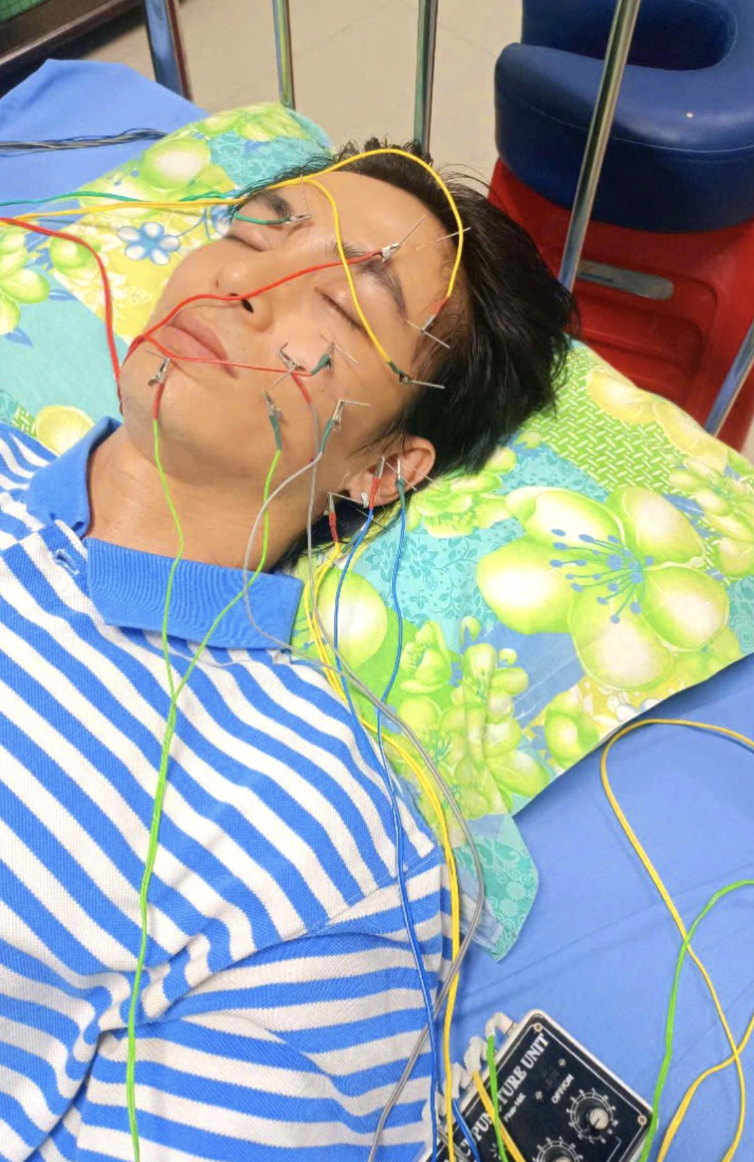 Nam thần Vbiz tiết lộ bị liệt dây thần kinh số 7: Mặt biến dạng, mất luôn giọng nói- Ảnh 7.