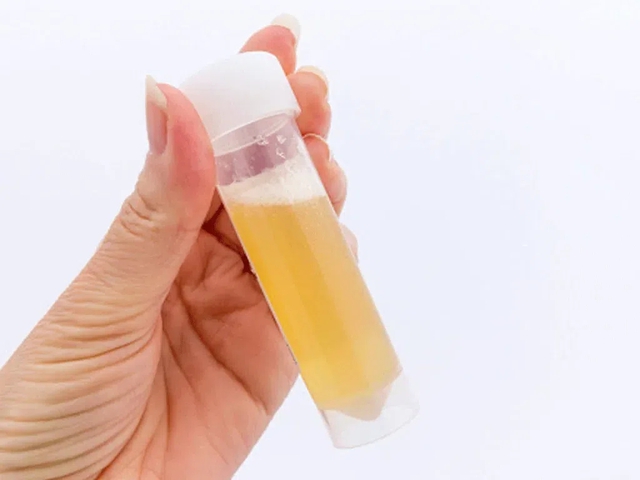 Sáng ngủ dậy thấy 5 dấu hiệu này, cẩn trọng vì có thể thận đang "lâm nguy": Có 1 cũng cần đi khám gấp- Ảnh 2. Sáng ngủ dậy thấy 5 dấu hiệu này, cẩn trọng vì có thể thận đang "lâm nguy": Có 1 cũng cần đi khám gấp- Ảnh 2.