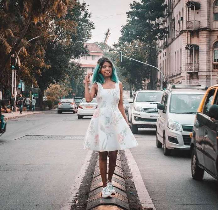 Bé gái bị cha tạt axit vì "không phải con trai" khi mới 2 tháng tuổi, tưởng không sống được bao lâu nào ngờ hiện tại có cuộc đời đáng kinh ngạc - Ảnh 3.