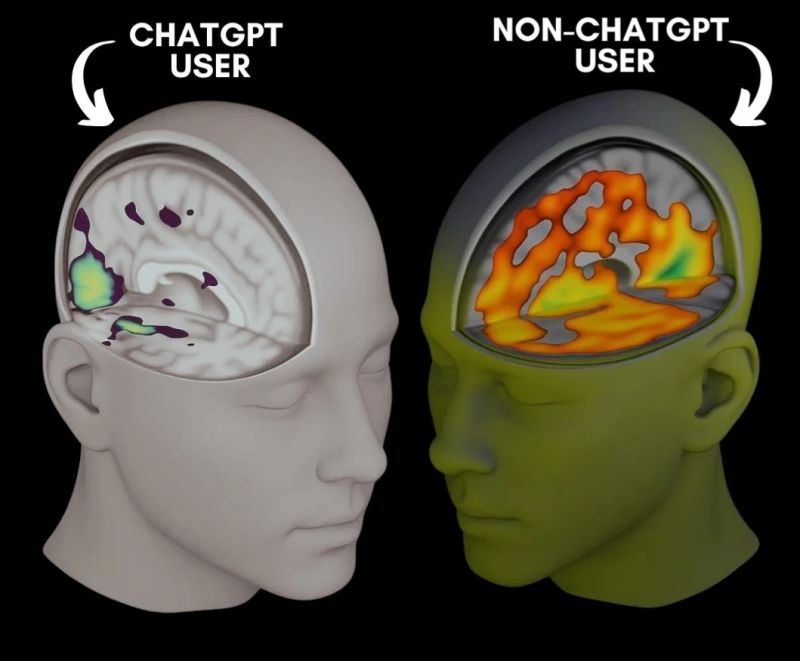 Lần đầu quét não người dùng ChatGPT, MIT phát hiện điều khiến cả thế giới chấn động - Ảnh 1.