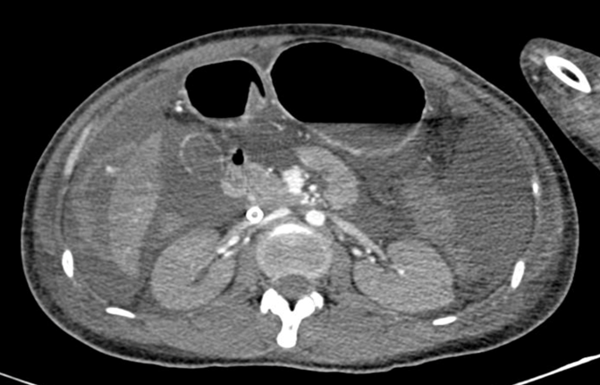 TP.HCM: Cô gái NGỪNG TIM liên tục ở tuổi 25, bác sĩ cũng phải thốt lên 'gặp một lần trong đời'” - Ảnh 1.
