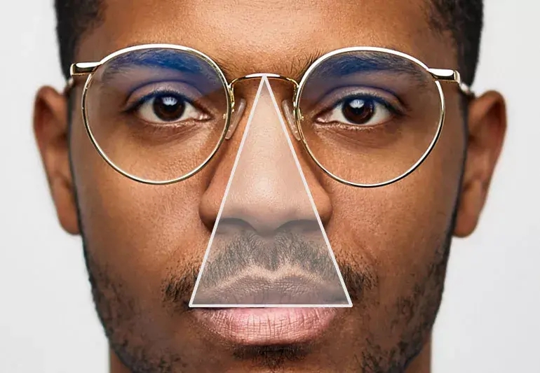 Nặn mụn vùng 'tam giác tử thần' trên mặt, chuyên gia cảnh báo điều nguy hiểm - Ảnh 1.