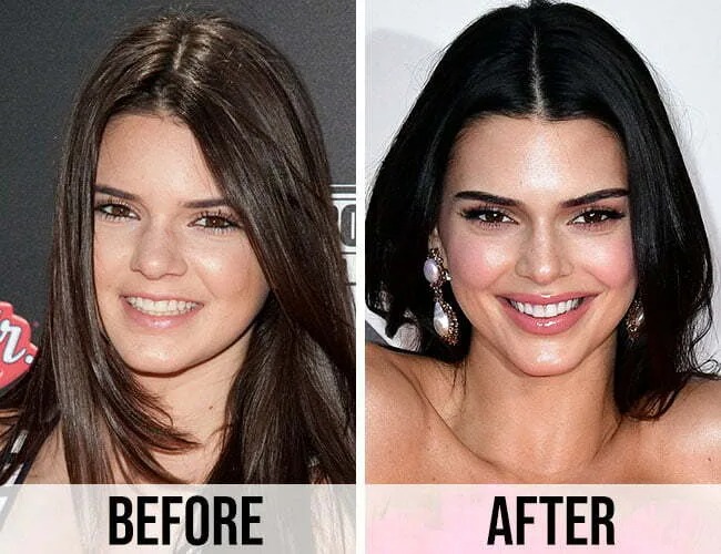 Nhà Kardashian - Jenner bị bóc mẽ nhan sắc giả dối: Từ mẹ đến con đều "cà ảnh" đến dị dạng bộ phận này- Ảnh 12. Nhà Kardashian - Jenner bị bóc mẽ nhan sắc giả dối: Từ mẹ đến con đều "cà ảnh" đến dị dạng bộ phận này- Ảnh 12.
