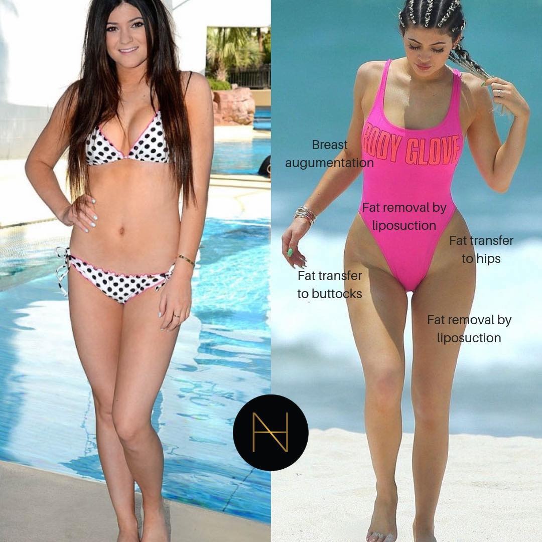 Nhà Kardashian - Jenner bị bóc mẽ nhan sắc giả dối: Từ mẹ đến con đều "cà ảnh" đến dị dạng bộ phận này- Ảnh 7. Nhà Kardashian - Jenner bị bóc mẽ nhan sắc giả dối: Từ mẹ đến con đều "cà ảnh" đến dị dạng bộ phận này- Ảnh 7.