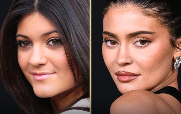 Nhà Kardashian - Jenner bị bóc mẽ nhan sắc giả dối: Từ mẹ đến con đều "cà ảnh" đến dị dạng bộ phận này- Ảnh 6. Nhà Kardashian - Jenner bị bóc mẽ nhan sắc giả dối: Từ mẹ đến con đều "cà ảnh" đến dị dạng bộ phận này- Ảnh 6.