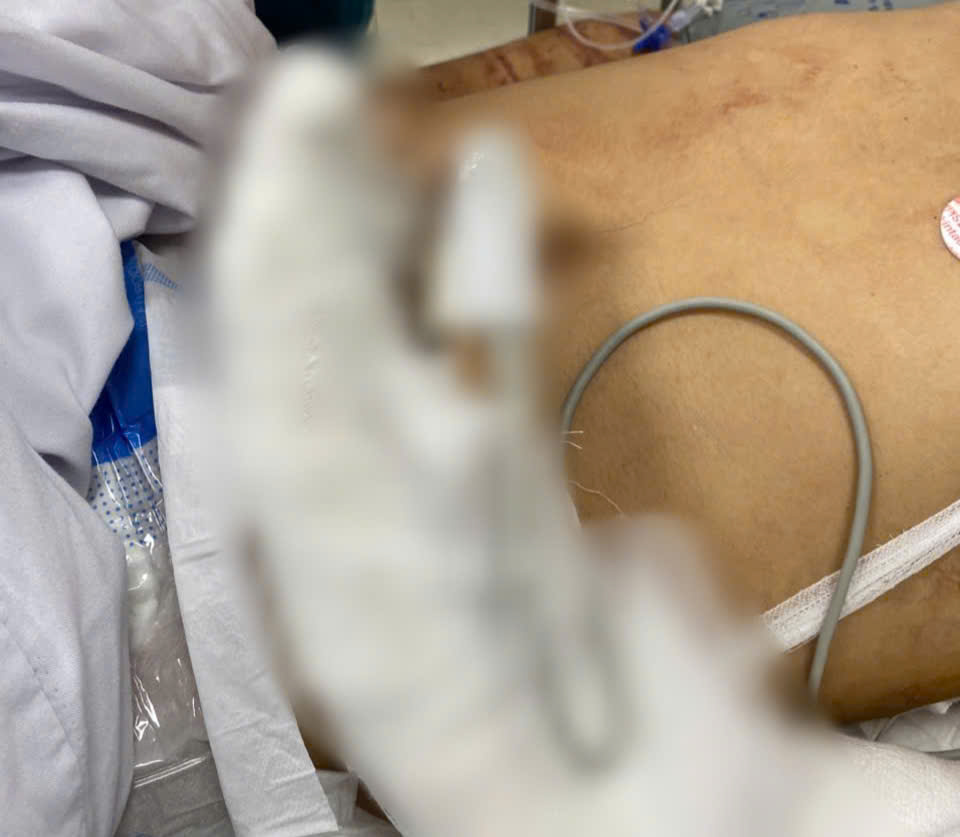 Người đàn ông bị chém đứt tay: Vụ tấn công kinh hoàng ở Hải Phòng - Ảnh 2. Người đàn ông bị chém đứt tay: Vụ tấn công kinh hoàng ở Hải Phòng - Ảnh 2.