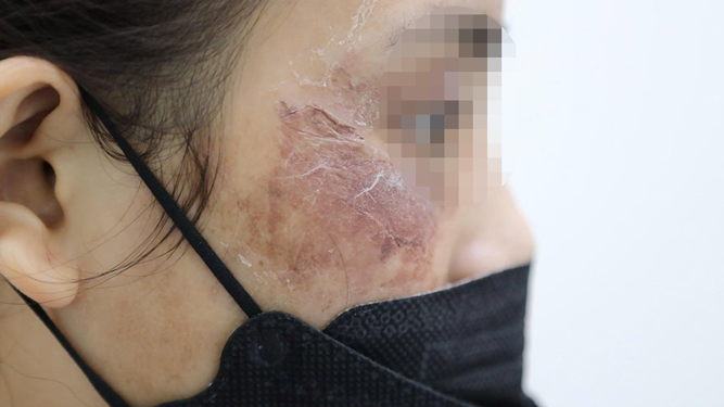 Mỹ phẩm online chưa thôi gây họa - Ảnh 1. Mỹ phẩm online chưa thôi gây họa - Ảnh 1.