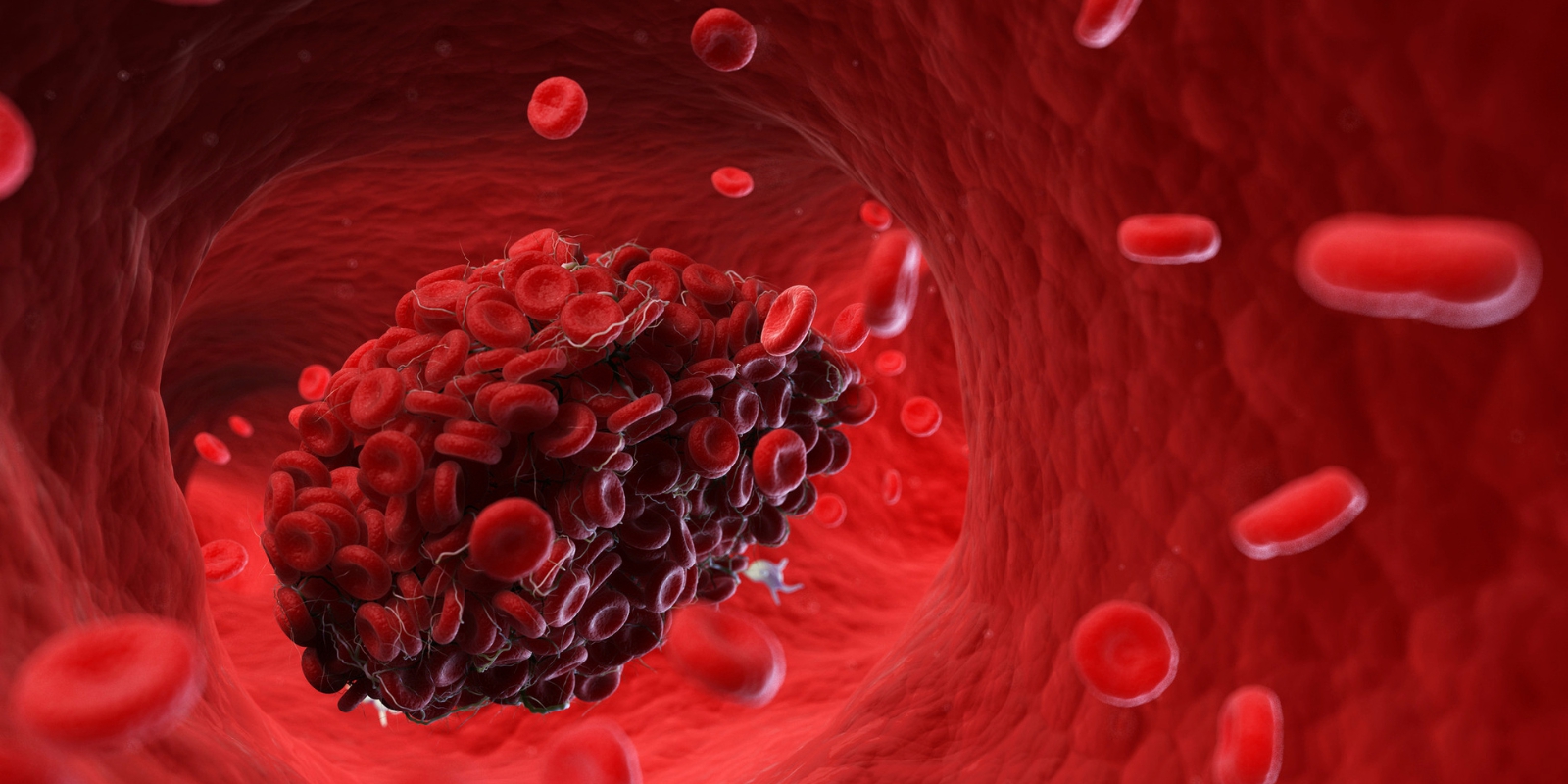 Cục máu đông rất "sợ" 1 thói quen buổi sáng: Thường xuyên làm giúp tránh xa đột quỵ, đau tim - Ảnh 1.