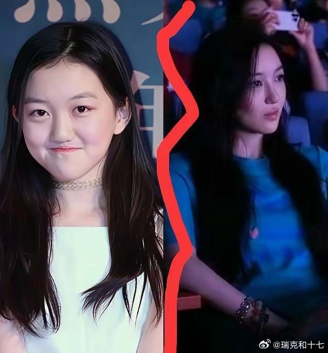 Không nhận ra con gái 19 tuổi của Vương Phi sau 4 lần phẫu thuật hở hàm ếch- Ảnh 5. Không nhận ra con gái 19 tuổi của Vương Phi sau 4 lần phẫu thuật hở hàm ếch- Ảnh 5.