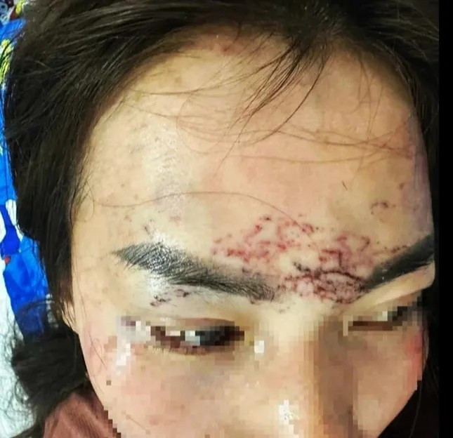 Diễn biến vụ phụ nữ đánh ghen , đổ axit ở Cà Mau gây chấn động cộng đồng - Ảnh 1.