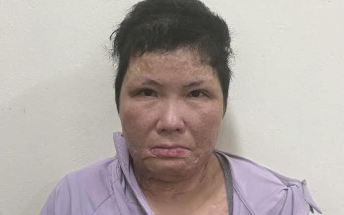 Diễn biến vụ 2 phụ nữ đánh ghen, đổ axit, xăm mặt người khác ở Cà Mau - Ảnh 2.