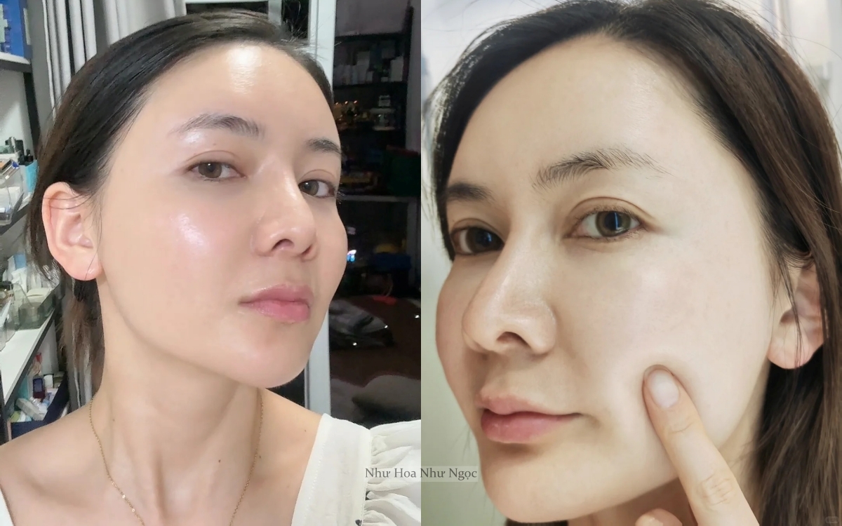 Thạc Sĩ 36 Tuổi Chia Sẻ Hành Trình Trị Mụn Ẩn Khoa Học: Da Sần Sùi Hóa Láng Mịn Chỉ Nhờ Hiểu Đúng- Ảnh 3. Thạc Sĩ 36 Tuổi Chia Sẻ Hành Trình Trị Mụn Ẩn Khoa Học: Da Sần Sùi Hóa Láng Mịn Chỉ Nhờ Hiểu Đúng- Ảnh 3.