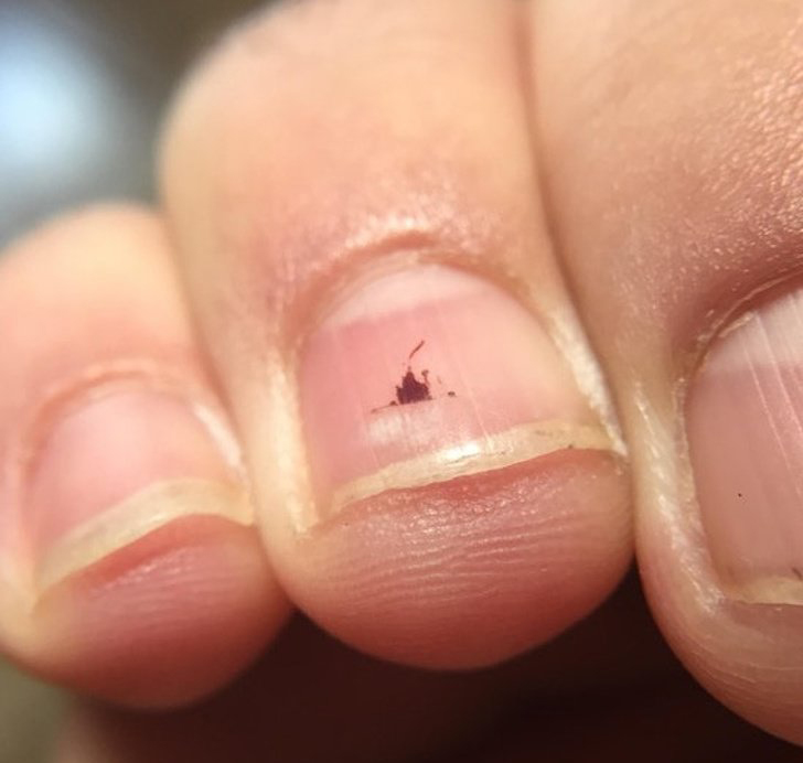 7 bất thường tr&ecirc;n m&oacute;ng tay lộ ngay người &ldquo;giấu&rdquo; khối u trong cơ thể, kiểm tra xem bạn c&oacute; kh&ocirc;ng! - Ảnh 2.