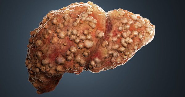 Người đen đủi sở hữu "GAN XẤU" s&aacute;ng dậy thường c&oacute; 5 điểm kh&aacute;c lạ, c&agrave;ng nhiều chứng tỏ gan "nhiễm độc" c&agrave;ng s&acirc;u! - Ảnh 3.