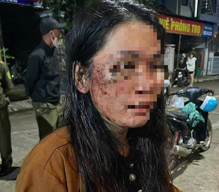 Diễn biến mới vụ nữ shipper bị hành hung gây xôn xao dư luận - Ảnh 1.