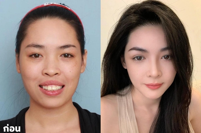 5 cô gái Việt là "nhân chứng" cho sự thay đổi cuộc sống nhờ "dao kéo": Đẹp, giàu, bản sao Phạm Băng Băng - Ảnh 11.