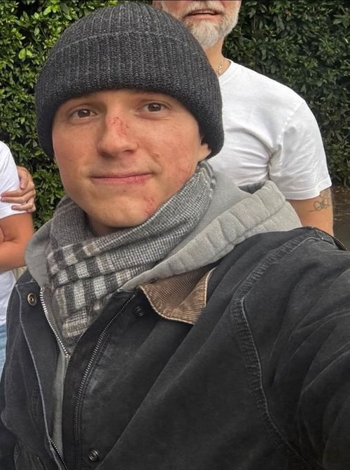 'Người Nhện' Tom Holland chấn thương não- Ảnh 1.