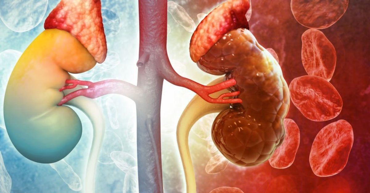 Bé 13 tuổi bất ngờ bị suy thận, suy tim: Bố mẹ bật khóc, hối hận vì không làm điều này sớm hơn- Ảnh 2.