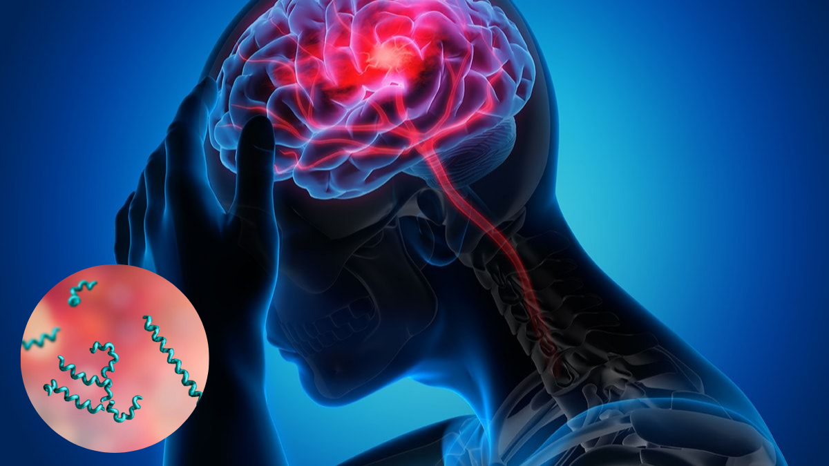 Người đàn ông đột quỵ 2 lần trong 1 tháng dù không mắc huyết áp cao hay mỡ máu: "Thủ phạm" gây bất ngờ- Ảnh 2.