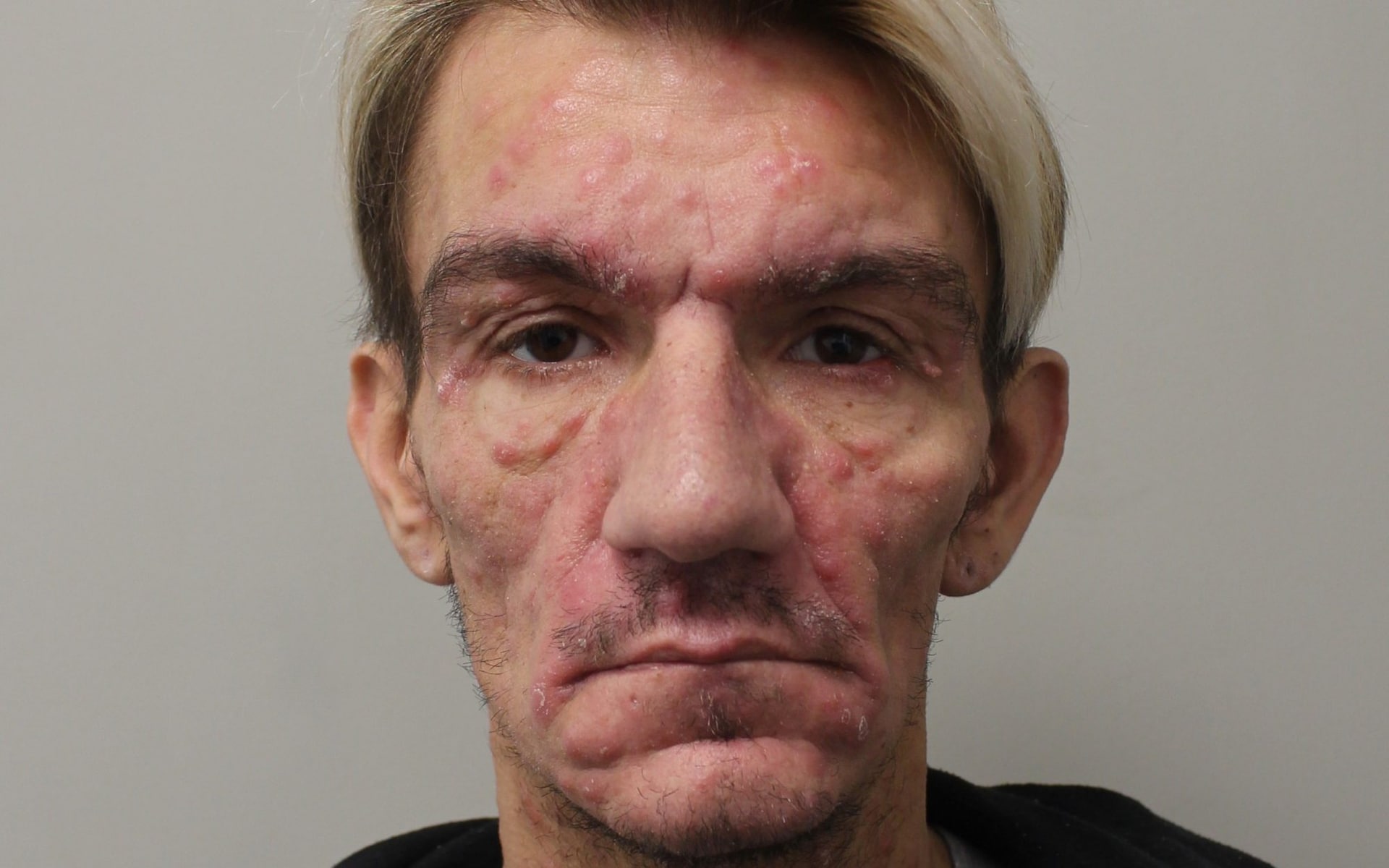 Telegraph: Cảnh sát Anh lo ngại hàng trăm người có thể đã nhiễm HIV từ Telegraph: Cảnh sát Anh lo ngại hàng trăm người có thể đã nhiễm HIV từ