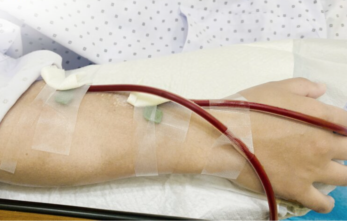 Ăn uống lành mạnh, chăm tập thể dục nhưng phải cắt cả 2 thận chỉ trong vòng 1 năm: "Thủ phạm" lộ diện- Ảnh 1. Ăn uống lành mạnh, chăm tập thể dục nhưng phải cắt cả 2 thận chỉ trong vòng 1 năm: "Thủ phạm" lộ diện- Ảnh 1.