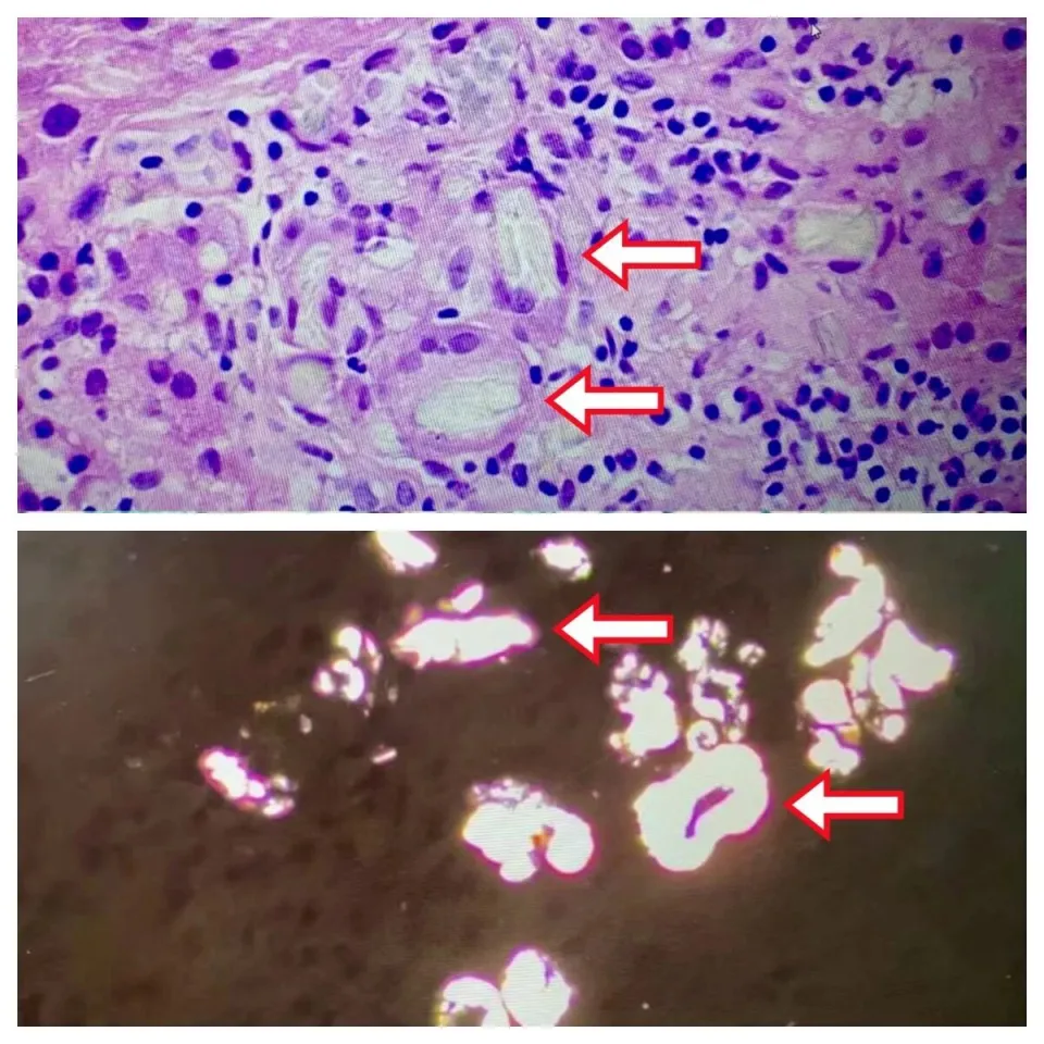 Người đ&agrave;n &ocirc;ng suy thận v&igrave; ăn rau n&agrave;y h&agrave;ng ng&agrave;y- Ảnh 2.