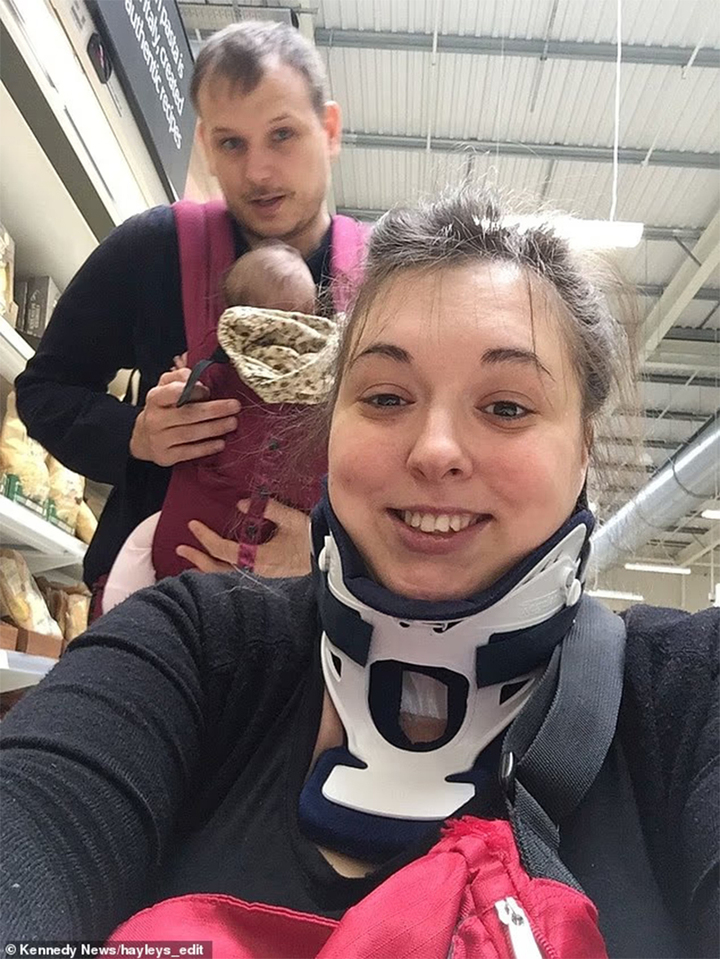 Nguy kịch vì ngáp quá mạnh, người phụ nữ thoát chết nhưng bị liệt- Ảnh 2.