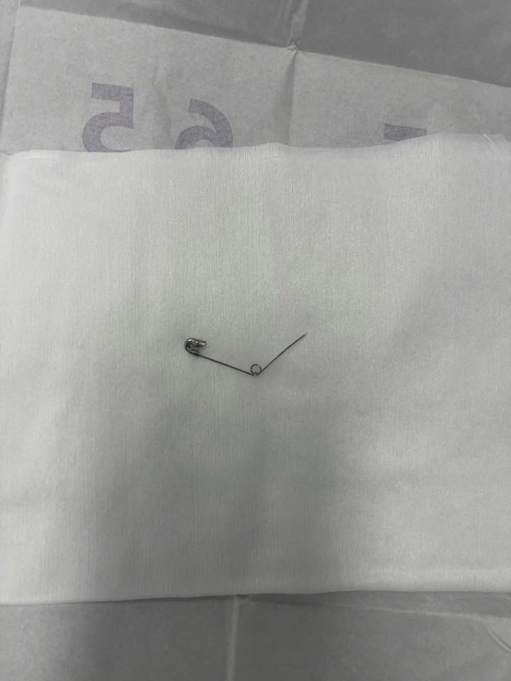 Vụ cô gái nuốt kim băng đang mở khi ăn ốc: Chính chủ nói rõ lý do nuốt vật nhọn mà không hay biết- Ảnh 4.