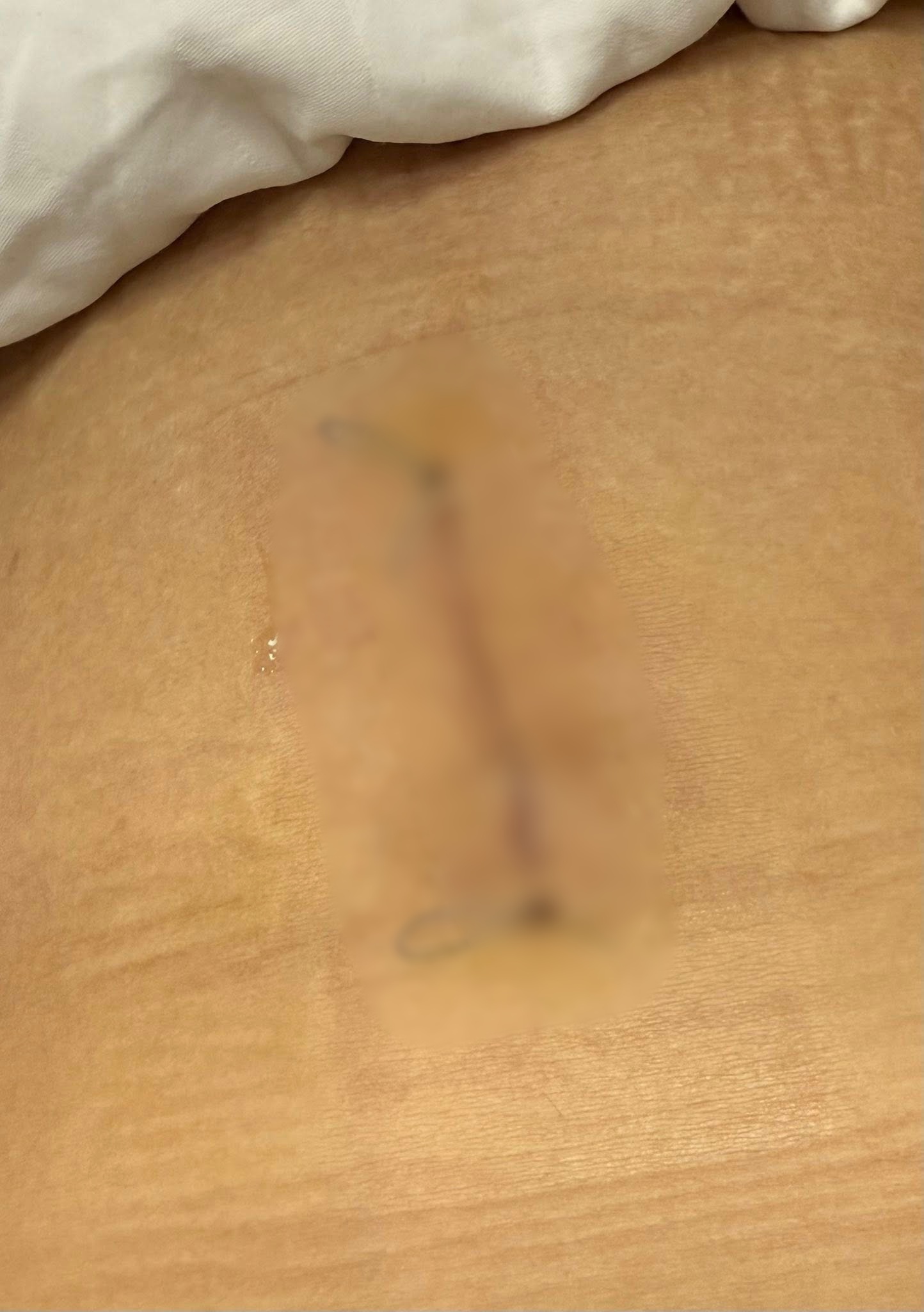 Vụ cô gái nuốt kim băng đang mở khi ăn ốc: Chính chủ nói rõ lý do nuốt vật nhọn mà không hay biết- Ảnh 5.