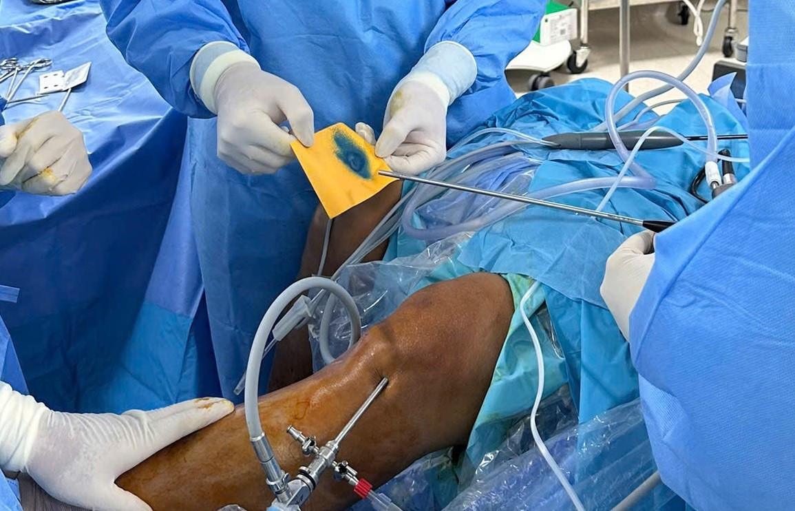 Việt Nam Điều Trị Thành Công Thoái Hóa Khớp Bằng Phương Pháp Hoàn Toàn Mới- Ảnh 2. Việt Nam Điều Trị Thành Công Thoái Hóa Khớp Bằng Phương Pháp Hoàn Toàn Mới- Ảnh 2.