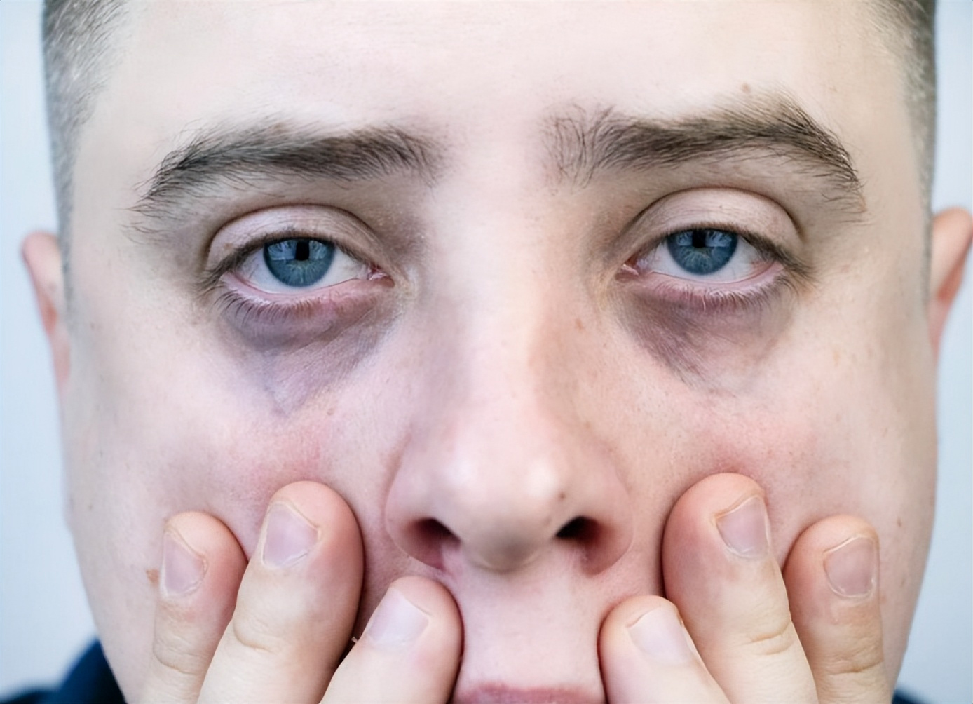 4 đặc điểm tr&ecirc;n khu&ocirc;n mặt b&aacute;o hiệu bệnh tật hoặc ung thư: Đừng nhầm lẫn ch&uacute;ng với 