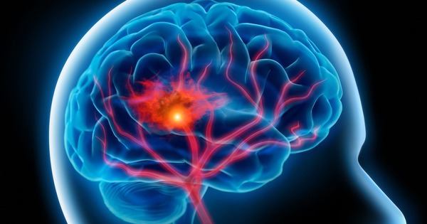 Đột quỵ thường "rình rập" những người có thói quen này vào buổi tối: Nếu có hãy bỏ ngay - Ảnh 3.