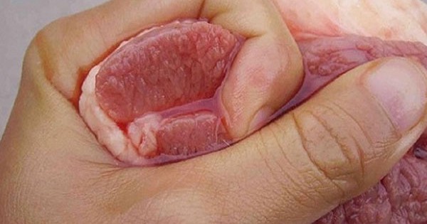 5 loại thịt không nên mua để tránh nguy cơ sức khỏe - Ảnh 3.