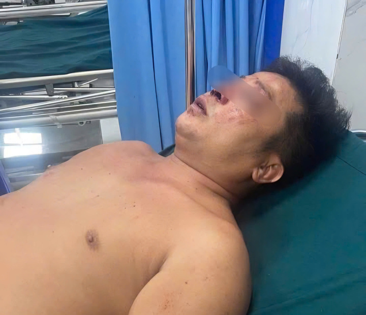 Điều tra vụ hành hung giúp người gặp nạn ở Bắc Ninh khiến hai anh em nhập viện - Ảnh 2. Điều tra vụ hành hung giúp người gặp nạn ở Bắc Ninh khiến hai anh em nhập viện - Ảnh 2.