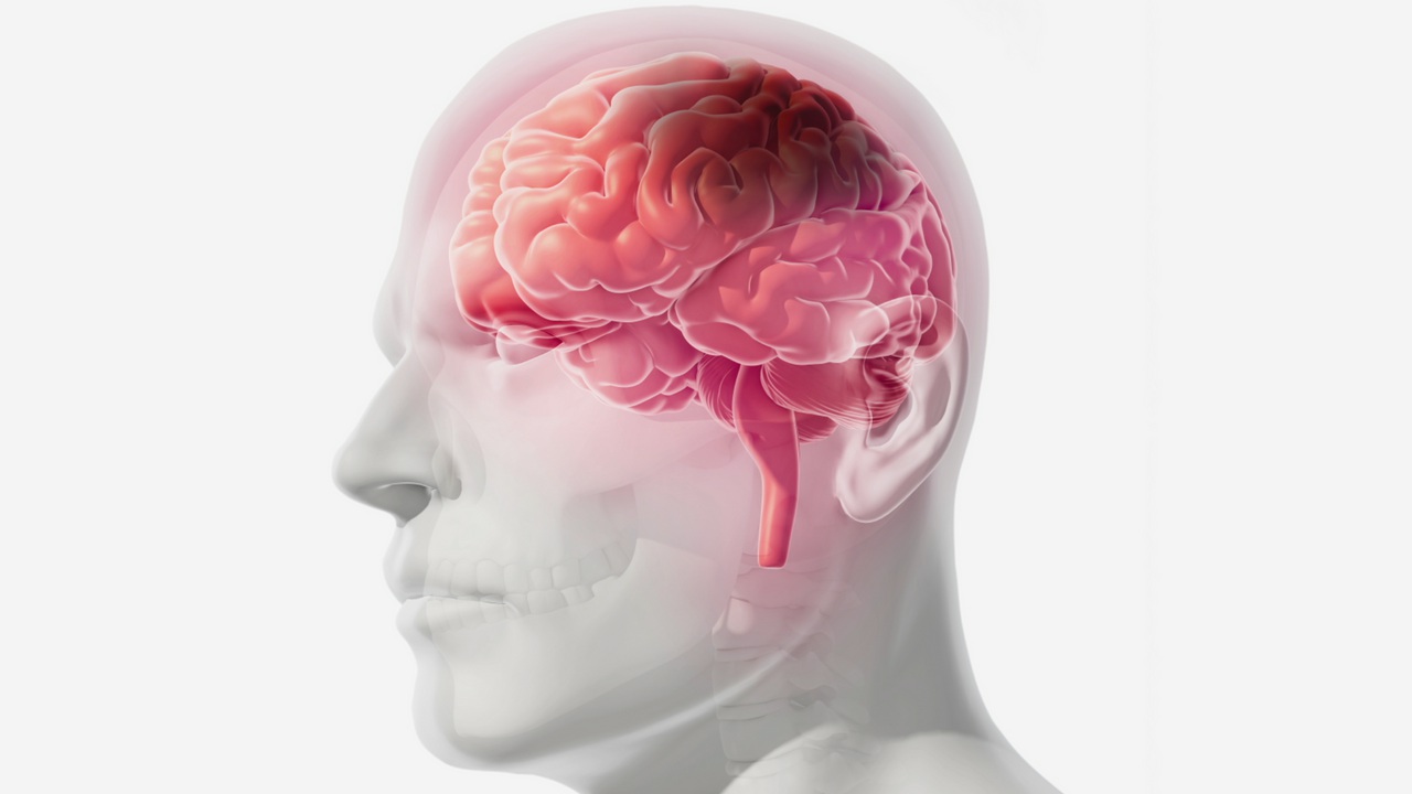 Bị đột quỵ và liệt nửa người vĩnh viễn, người phụ nữ hối hận vì đã bỏ qua 1 dấu hiệu kéo dài trong 3 ngày - Ảnh 2.