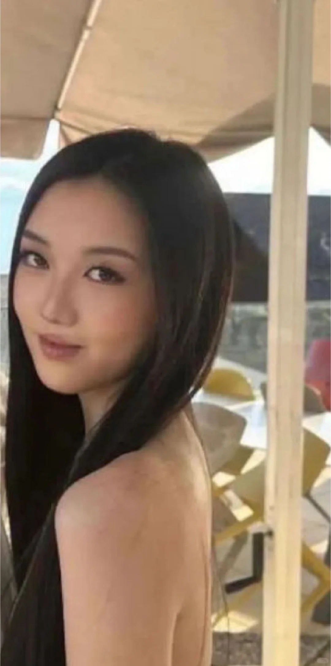 Con g&aacute;i Vương Phi diện mạo kh&oacute; tin sau 4 lần phẫu thuật hở h&agrave;m ếch, đ&atilde; c&oacute; bạn trai ở tuổi 20- Ảnh 1.