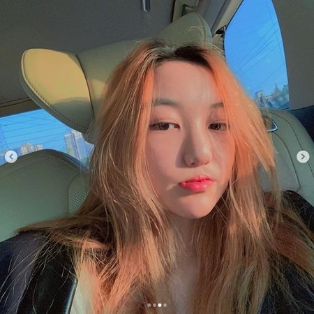 Con g&aacute;i Vương Phi diện mạo kh&oacute; tin sau 4 lần phẫu thuật hở h&agrave;m ếch, đ&atilde; c&oacute; bạn trai ở tuổi 20- Ảnh 2.