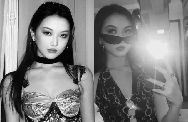 Con g&aacute;i Vương Phi diện mạo kh&oacute; tin sau 4 lần phẫu thuật hở h&agrave;m ếch, đ&atilde; c&oacute; bạn trai ở tuổi 20- Ảnh 10.