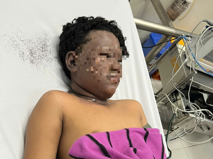 B&eacute; trai 13 tuổi &ocirc;m mặt chạy về b&aacute;o gia đ&igrave;nh sau khi c&ugrave;ng bạn nghịch ph&aacute;o  - Ảnh 1.