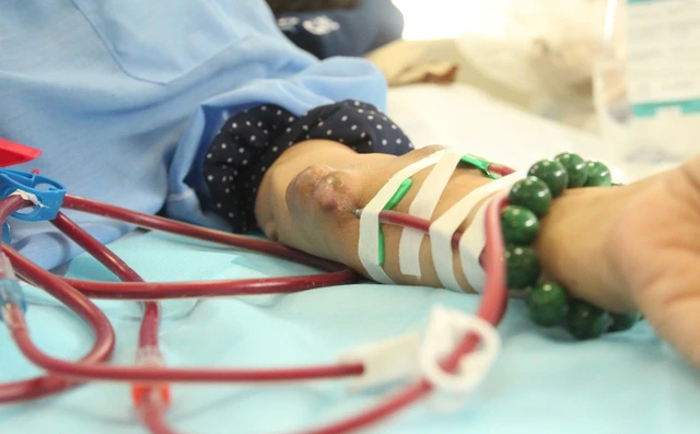 C&aacute;nh tay của người chạy thận h&oacute;a ra tr&ocirc;ng thế n&agrave;y: 1 vũ c&ocirc;ng chuy&ecirc;n mặc &aacute;o d&agrave;i tay 1 b&ecirc;n đ&atilde; "thức tỉnh" những ai kh&ocirc;ng biết- Ảnh 3.