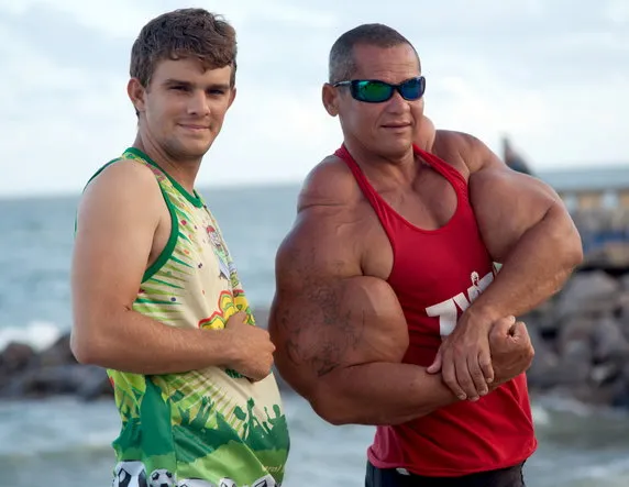 "Qu&aacute;i vật thể h&igrave;nh" Brazil sở hữu chu vi bắp tay l&ecirc;n tới 74cm đột ngột qua đời, b&aacute;c sĩ cảnh b&aacute;o 1 vấn đề sức khỏe tiềm ẩn- Ảnh 2.